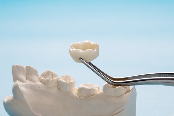 What Is Dental Crown Lengthening?