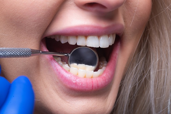 What To Know Before Starting Gum Disease Treatment