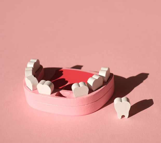 Berkeley Heights Periodontal Tooth Loss